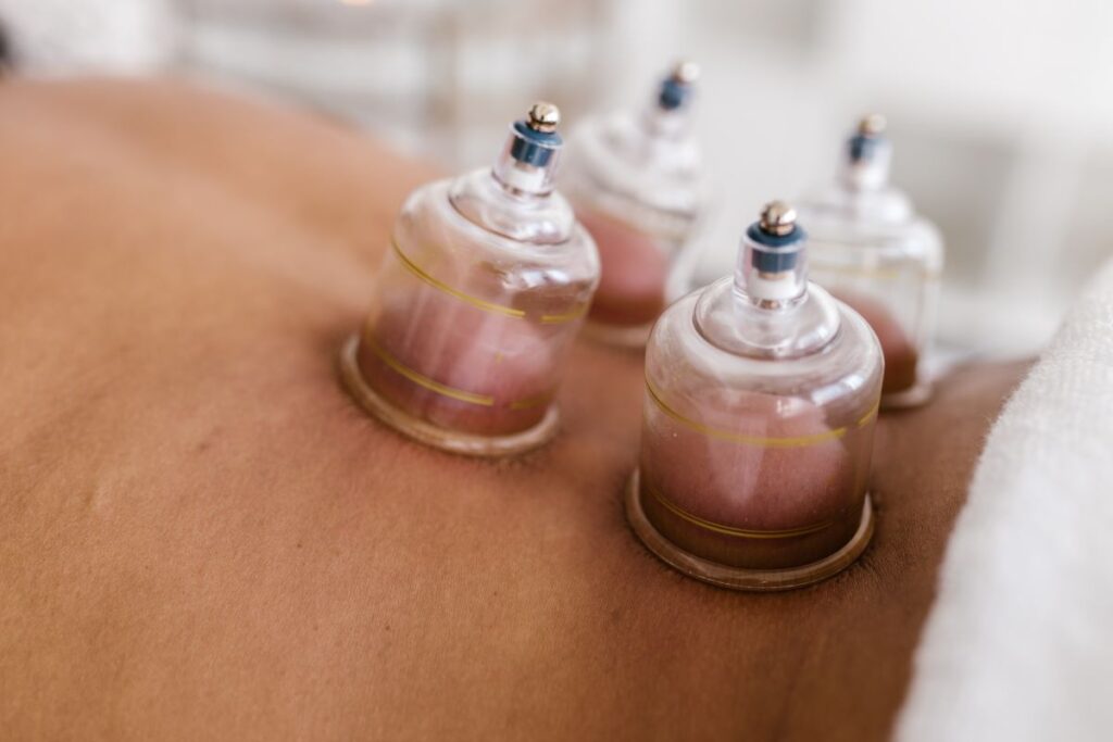 transformational cupping